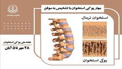 تاکید معاون بهداشتی شبکه فراشبند بر نقش خود مراقبتی در پیشگیری از پوکی استخوان/شکستگی مهمترین عارضه پوکی استخوان